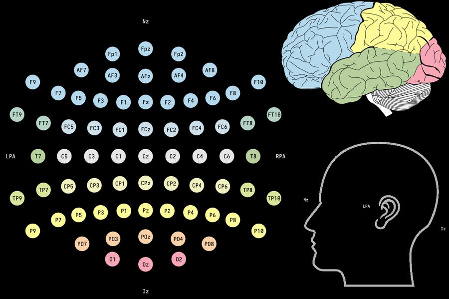 Archive: EEG 10-10 electrode-map diagram (Wikimedia Commons; File title Soft FLAG). Not the 14 September 2026 NMPA standard issuance and not Chinese BCI device photography.